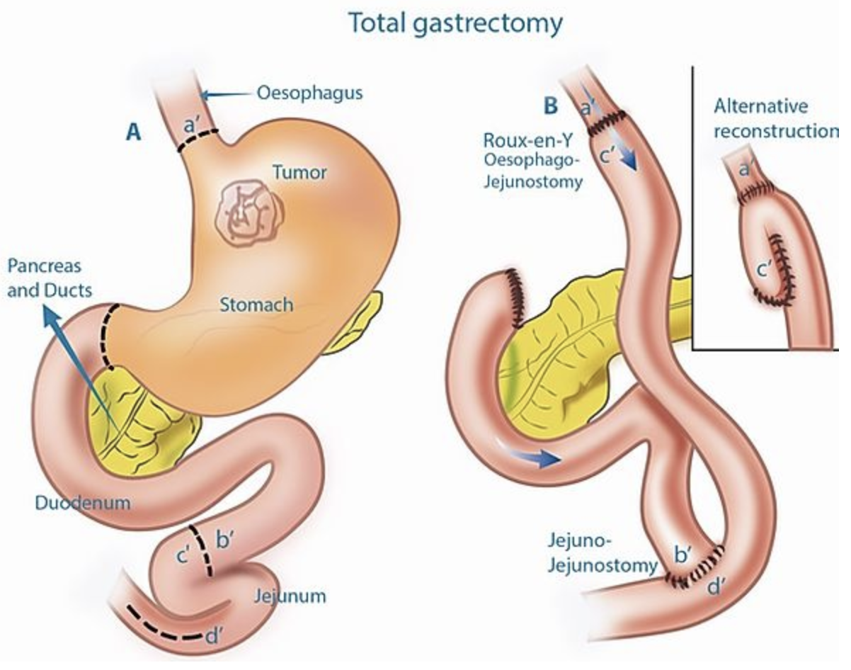 capture d’écran 2025 07 18 à 11.06.04